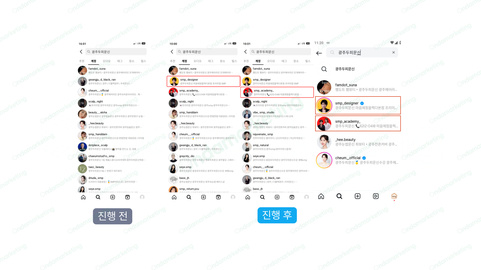 [계정탭] 두피문신